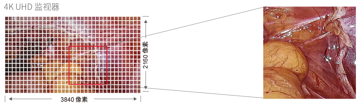 32英寸医疗手术室专用监视器